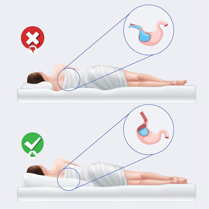 Acid Reflux Wedge