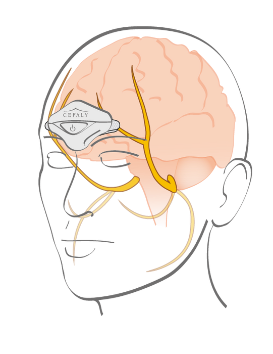CEFALY® Electrodes
